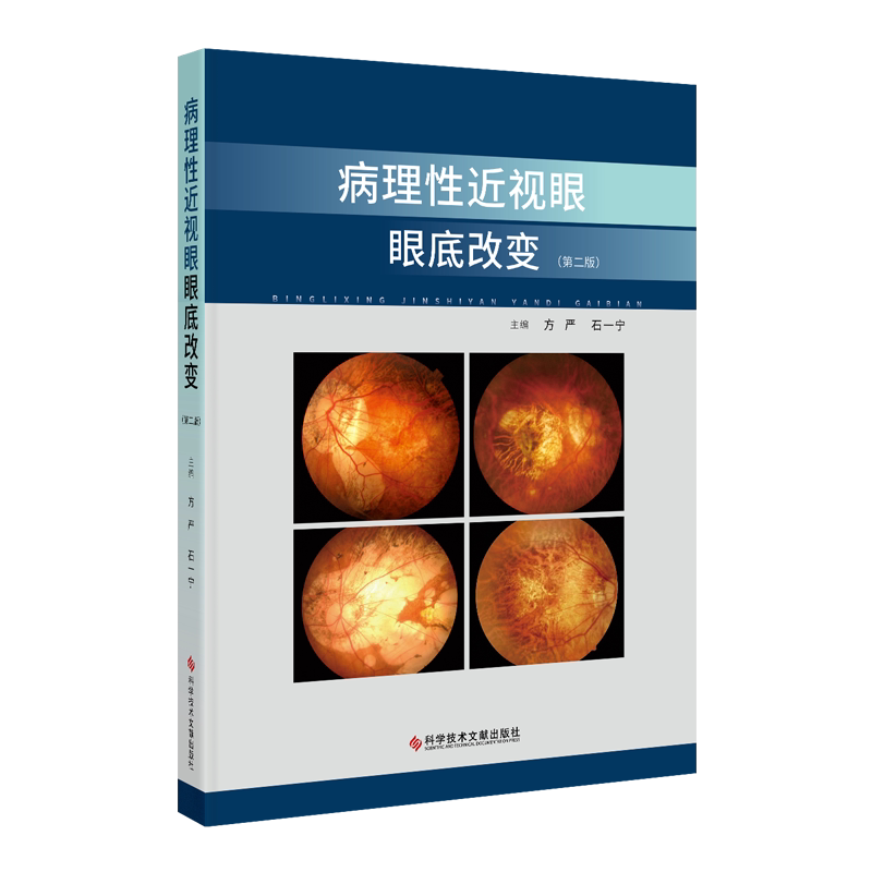 病理性近视眼眼底改变(第2版) 方严,石一宁 编 眼科学生活 新华书店正版图书籍 科学技术文献出版社