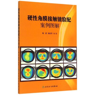 硬性角膜接触镜验配案例图解 梅颖、唐志萍 著 眼科学生活 新华书店正版图书籍 人民卫生出版社