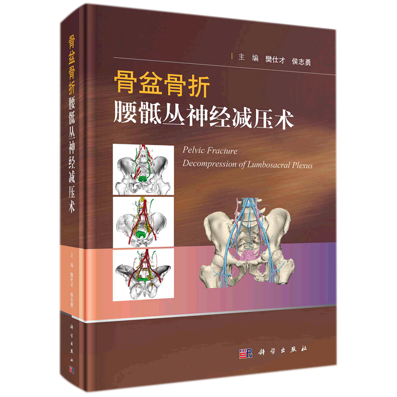 骨盆骨折腰骶丛神经减压术 樊仕才,侯志勇 著 外科学生活 新华书店正版图书籍 科学出版社