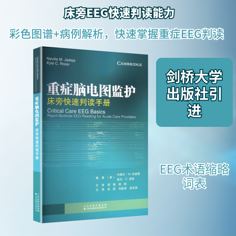 重症脑电图监护 床旁快速判读手册