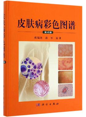 皮肤病彩色图谱(第4版) 虞瑞尧，漆军 著 皮肤病学/性病学生活 新华书店正版图书籍 科学出版社