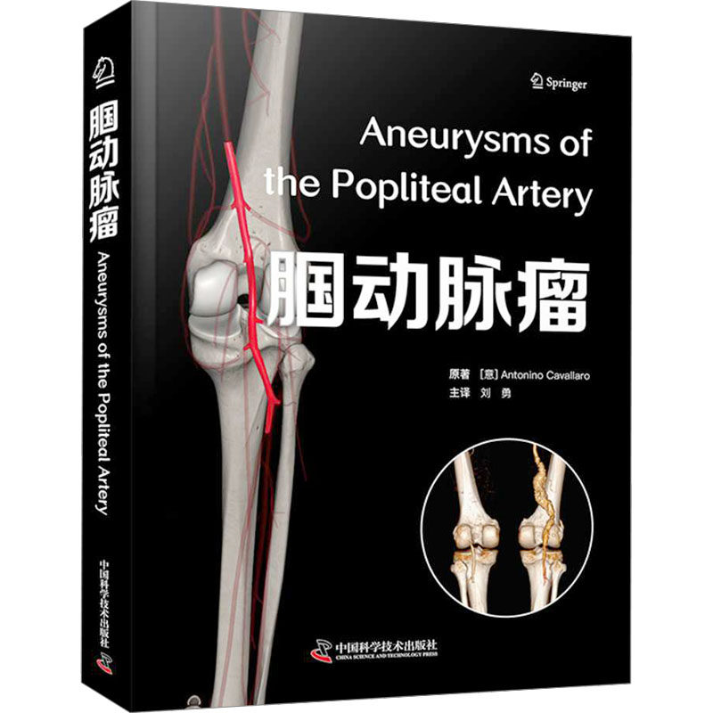 腘动脉瘤 (意)安东尼诺·卡瓦拉罗(Antonino Cavallaro) 著 刘勇 译 外科学生活 新华书店正版图书籍 中国科学技术出版社