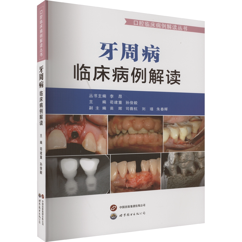 牙周病临床病例解读 苟建重,孙俊毅,李昂 编 口腔科学生活 新华书店正版图书籍 世界图书出版西安有限公司