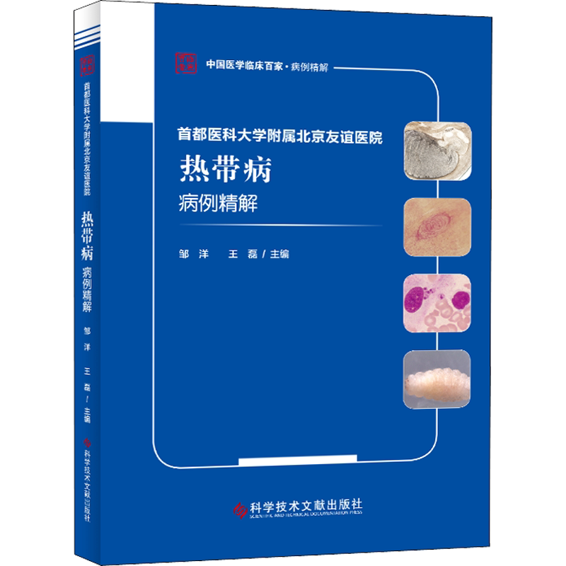 首都医科大学附属北京友谊医院热带病病例精解 邹洋,王磊 编 内科学生活 新华书店正版图书籍 科学技术文献出版社