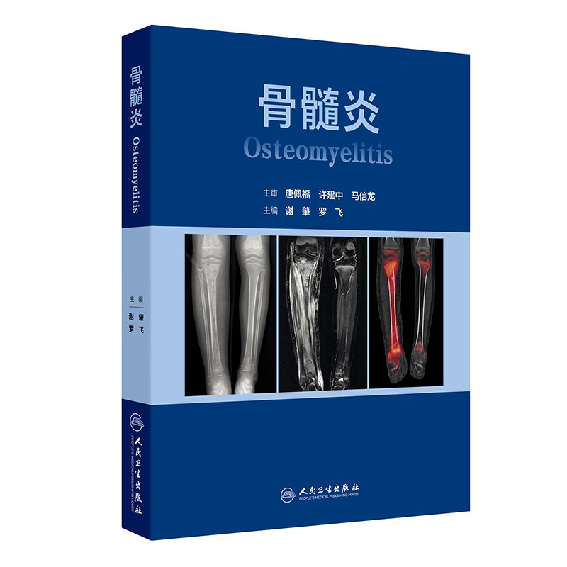 骨髓炎 谢肇,罗飞 主编 医学其它生活 新华书店正版图书籍 人民卫生出版社