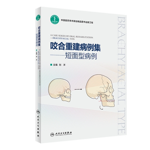咬合重建病例集——短面型病例 刘洋 编 口腔科学生活 新华书店正版图书籍 人民卫生出版社