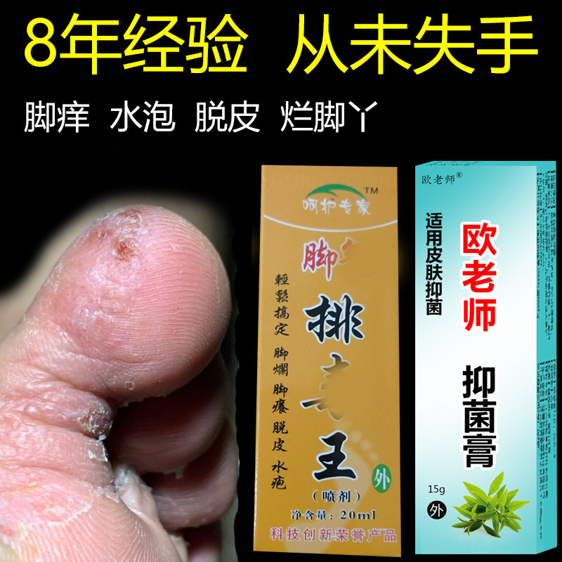 手痒脱皮水泡抑喷剂菌膏止痒烂脚丫脚痒治脚趾缝开裂脚上长水泡痒
