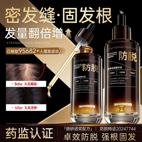 【防脱断货王TOP】密发科研专款