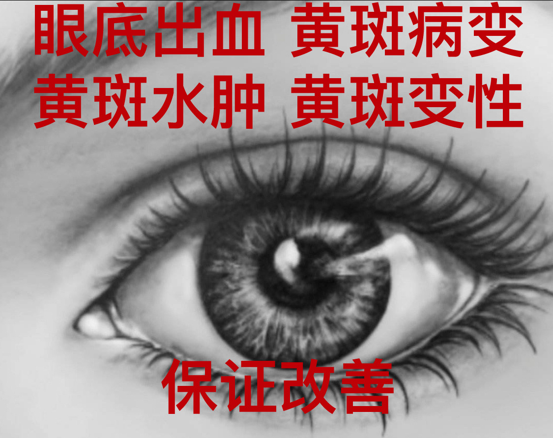 眼底出血治疗视力模糊家祖眼睛充血秘方结膜充血中药