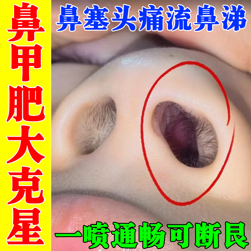 鼻子不通气神器嗅觉失灵鼻甲肥大专用特效药鼻息肉鼻干鼻堵塞喷剂