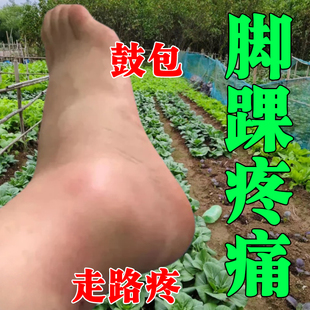 脚踝受伤崴脚走路神器扭伤脚踝热敷脚腕疼痛韧带拉伤恢复专用药膏