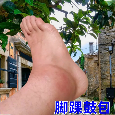 脚踝受伤崴脚走路神器扭伤脚踝热敷脚腕疼痛韧带拉伤恢复专用药膏