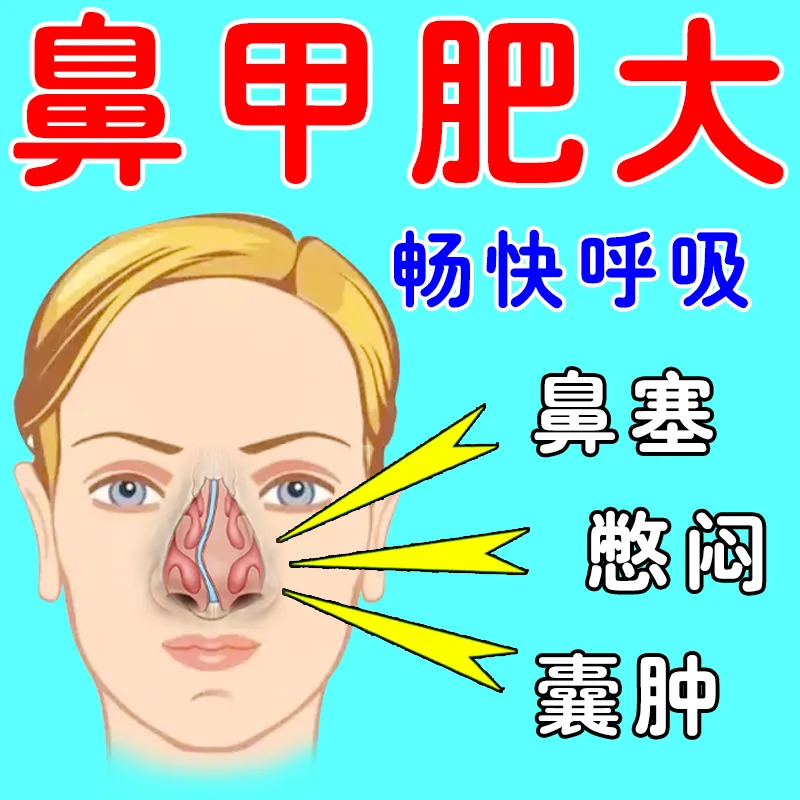 儿童鼻炎鼻塞鼻子不通气专用神器鼻甲肥大喷雾剂流脓鼻涕堵塞发痒