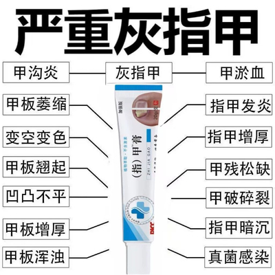 香港大药房灰指甲专用膏去