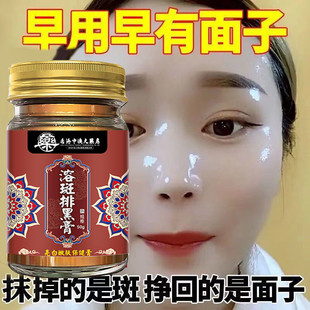【香港老牌子】霜色斑老年斑雀斑黄褐斑晒斑雀斑除斑液祛