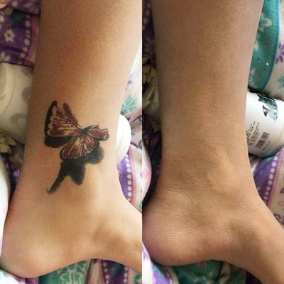 防水防汗疤痕特效化妆遮瑕膏