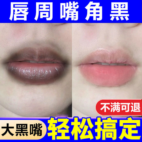 改善唇周黑嘴角暗沉去除嘴巴周边黑乌唇膜膏去死皮淡化唇纹部护理