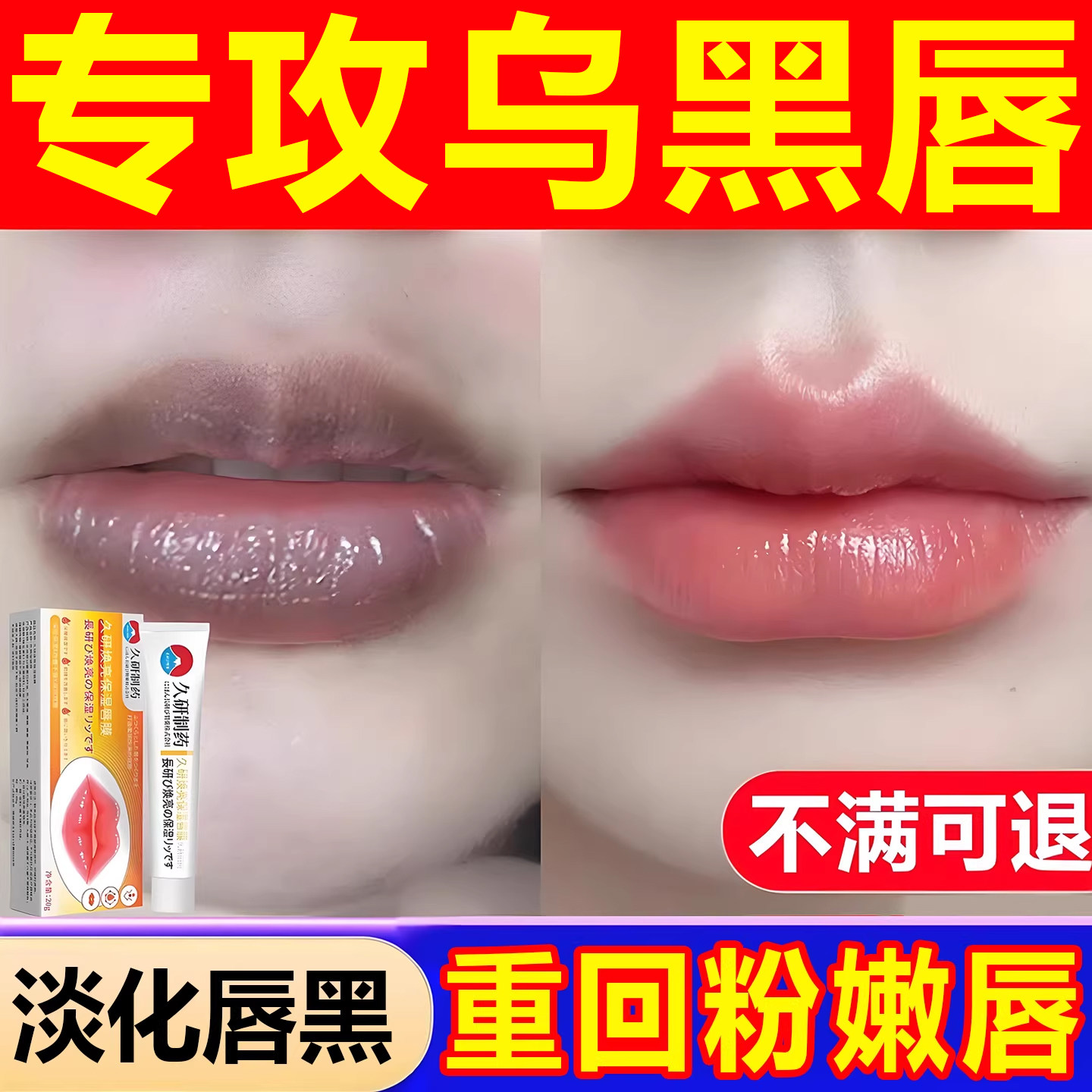 改善唇周黑嘴角暗沉去除嘴巴周边黑乌唇膜膏去死皮淡化唇纹部护理
