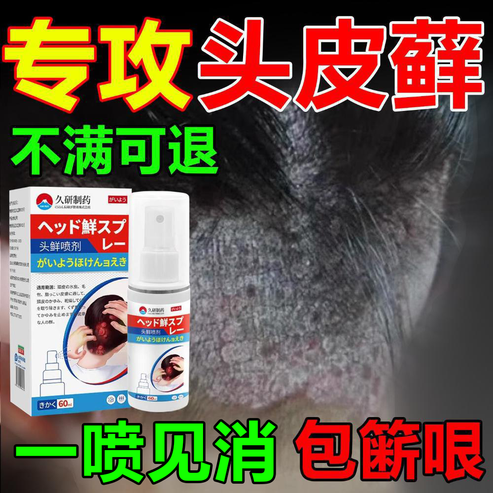 头皮癣专用去毛囊炎痒脂溢性皮焱疙瘩杀菌皮藓专用喷雾剂正品
