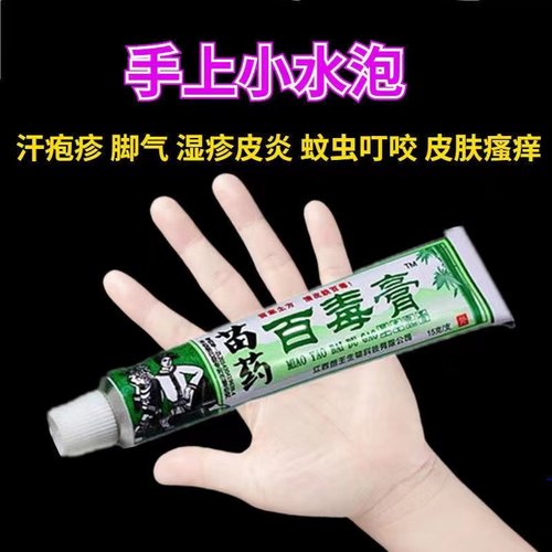 汗泡专用药膏解决您的困扰