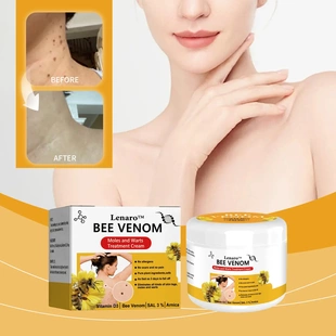 Treatment Cream Body Venom Care Kewl Cleansing Bee Gentle