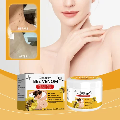 Bee Venom Kewl Treatment Cream Gentle Cleansing Care Body Sk