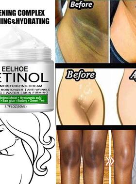 Body Whitening Cream Brightening Skin Tone Improve Dullness