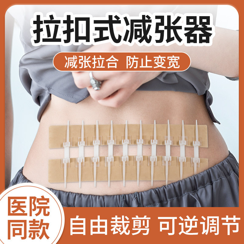 医用减张器剖腹产术后疤痕减张贴