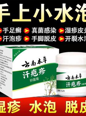 云南本草汗孢疹汗泡珍药膏止痒汉状真菌感染手气手上起小水泡