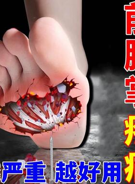 前脚掌疼痛贴脚底板疼痛肌肉韧带拉伤足底筋膜炎热敷神器专用药膏