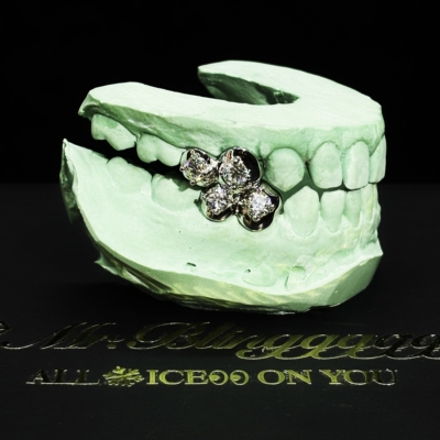 Mr.Bling蟑螂侠同款Grillz定制