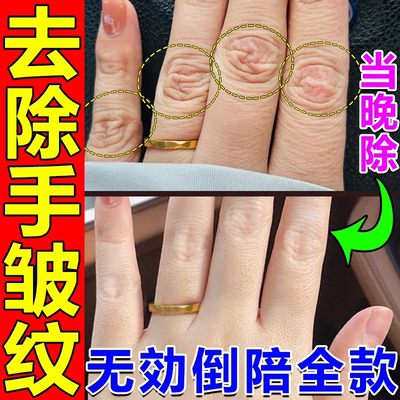 去手指关节皱纹手背暗沉暗淡去黑