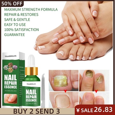 NailFungusTreatments