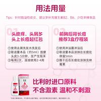 Caile Ketoconazole Shampoo, Seborrheic Dermatitis Anti-dandruff Shampoo, Dandruff, Seborrheic folliculitis Anti-itch, Caile thumbnail 3