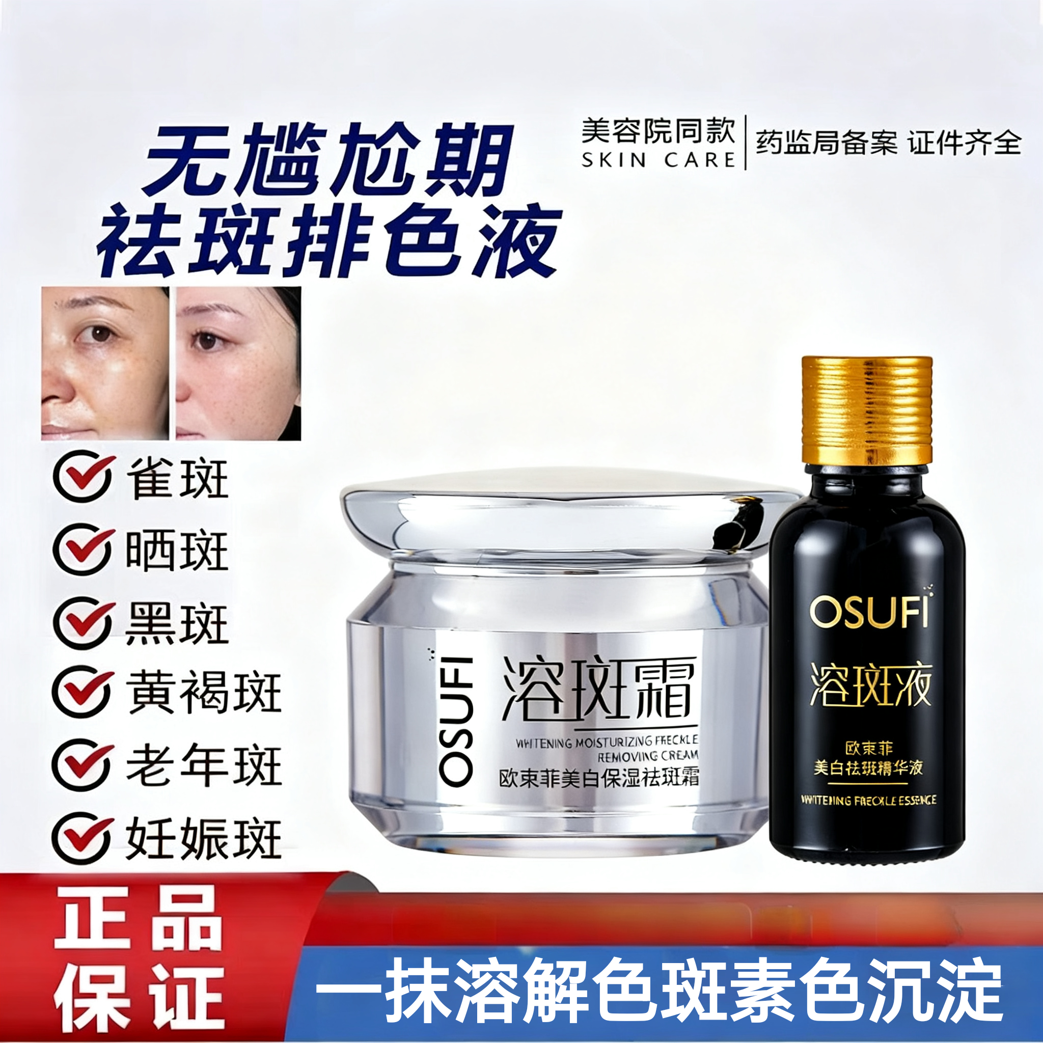 无尴尬期祛斑霜美容院专用去斑排色液老年斑雀斑免提取排斑精华液