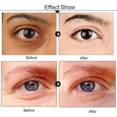 60pcs Wrinkle Eye Bag Whitening Sleep Mask眼纹黑眼圈眼膜眼贴
