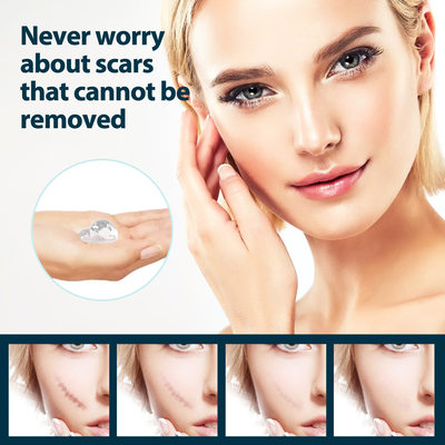 Scar Removal Gel Remove Fade Dark Skin Anti Scar Stretch Oin