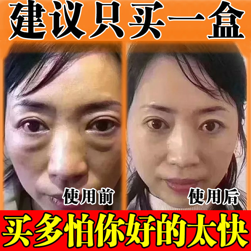 眼袋去除神器蛇毒眼霜一分钟大眼袋男士中老年黑眼圈淡化细纹正品
