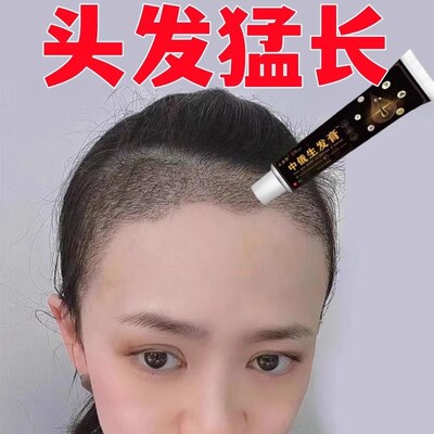 中俄生发膏放掉秃顶抑菌增发养发专用滋养快速密发男女通用