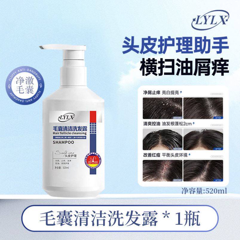 去屑洗发水毛囊控油止痒头皮清洁蓬松炎头膏男女官方正品牌洗发露