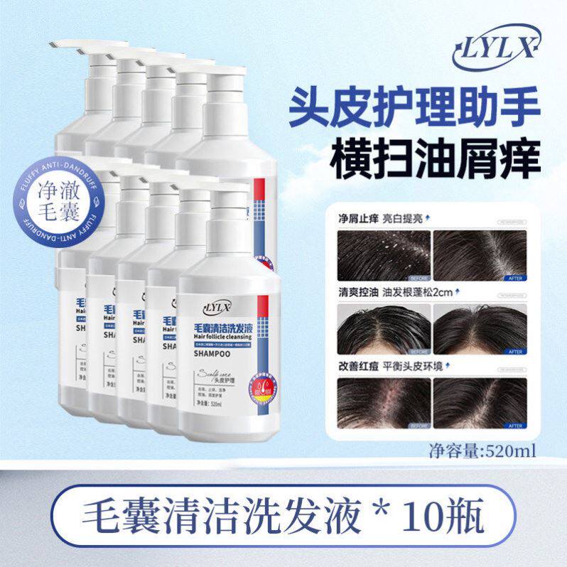 【小红书断货王】LYLX正品清爽控油蓬松头皮清洁进口淡清香洗发水