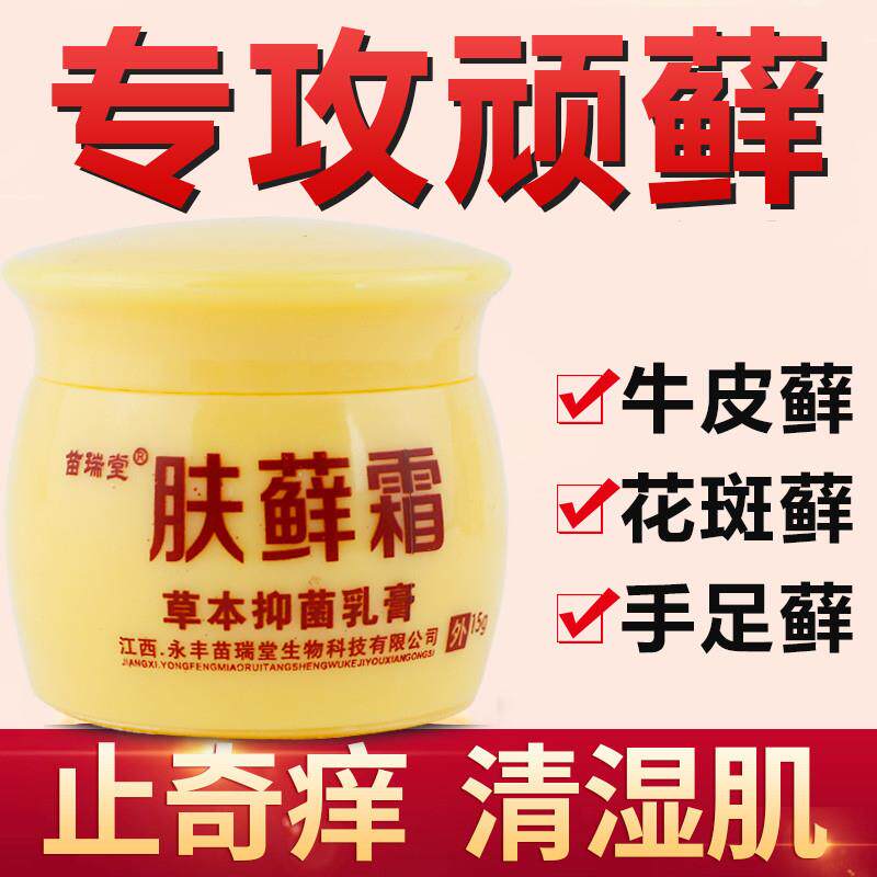 顽固牛皮藓花斑藓紫椒藓町体股鲜头皮瘙痒手脚脱皮皮肤外用无激素