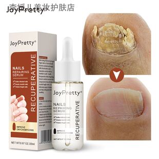 joypretty灰甲液凹凸厚甲现货灰指甲软甲修护液指缘油 指甲修护液