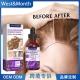 毛发密发精华液 West Month 头发防掉强韧固发浓密头皮营养按摩液