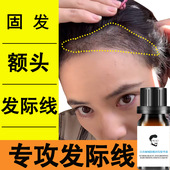 发际线生长液头发营养护理液防浓密液护发精油头皮精华液生发剂