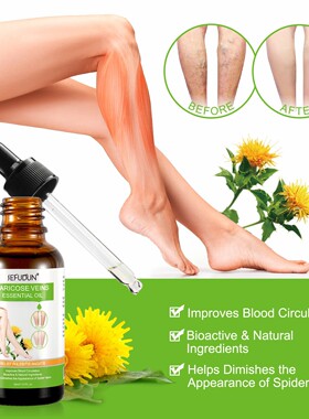 SEFUDUN 静脉精油VARICOSE VEINS ESSENTIAL OIL