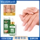 West Month灰指甲修护液 亮甲液凹凸厚甲增厚型灰甲软甲修护液