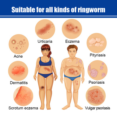 SouthMoon皮肤护理涂抹膏干男士保湿补水痱子乳膏女士跨境