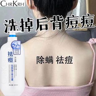滋润改善肌肤男女 沐浴露控油止痒祛痘持久留香抑菌除螨去鸡皮保湿