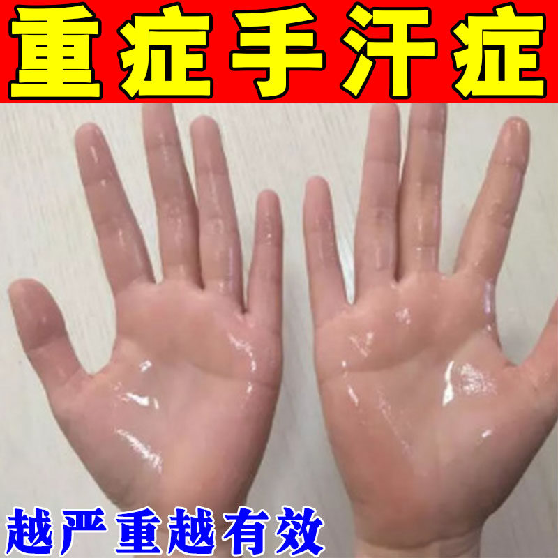 手汗症去手心手掌根手汗症止汗剂神器止汗露手脚多汗防止手出汗